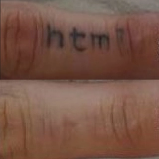 Фото сведение татуировки лазером